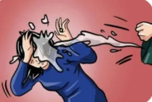 Perempuan di Sumba Barat Daya Diduga Disiram Air Panas, Alami Luka Bakar